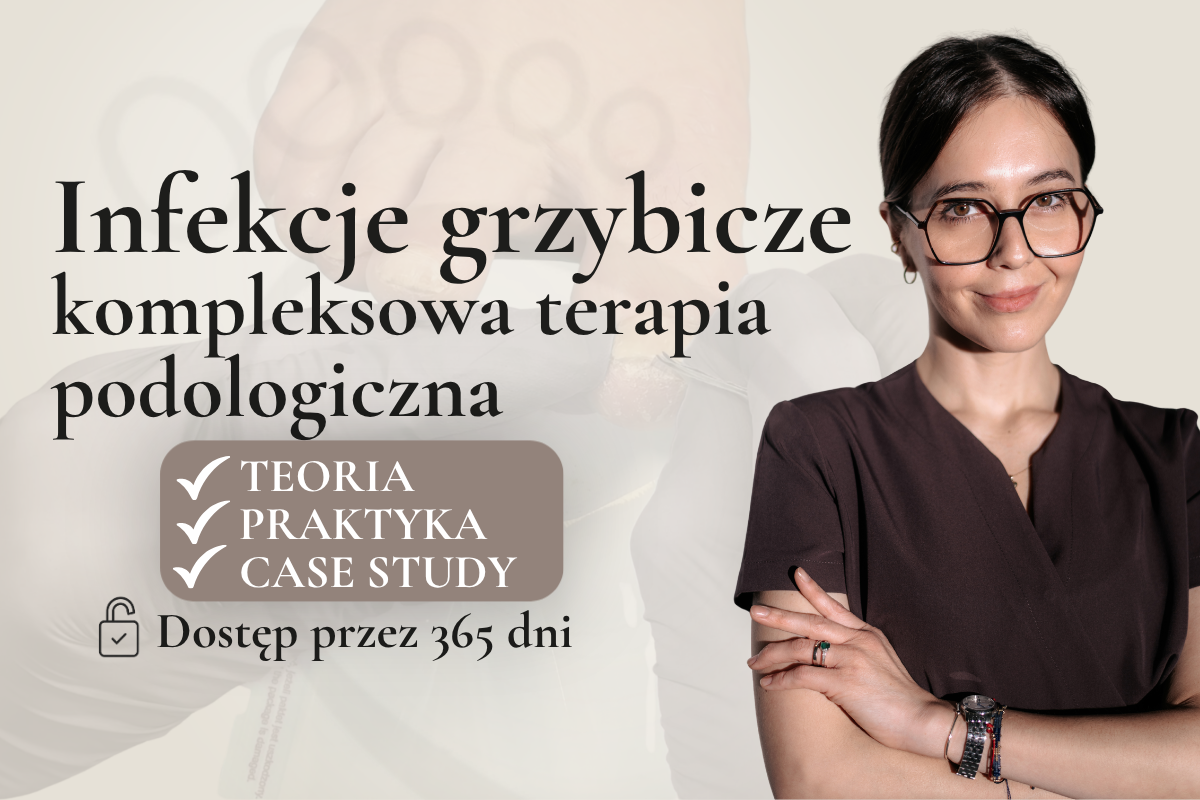 Infekcje grzybicze – kompleksowa terapia podologiczna